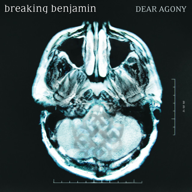 Albums
