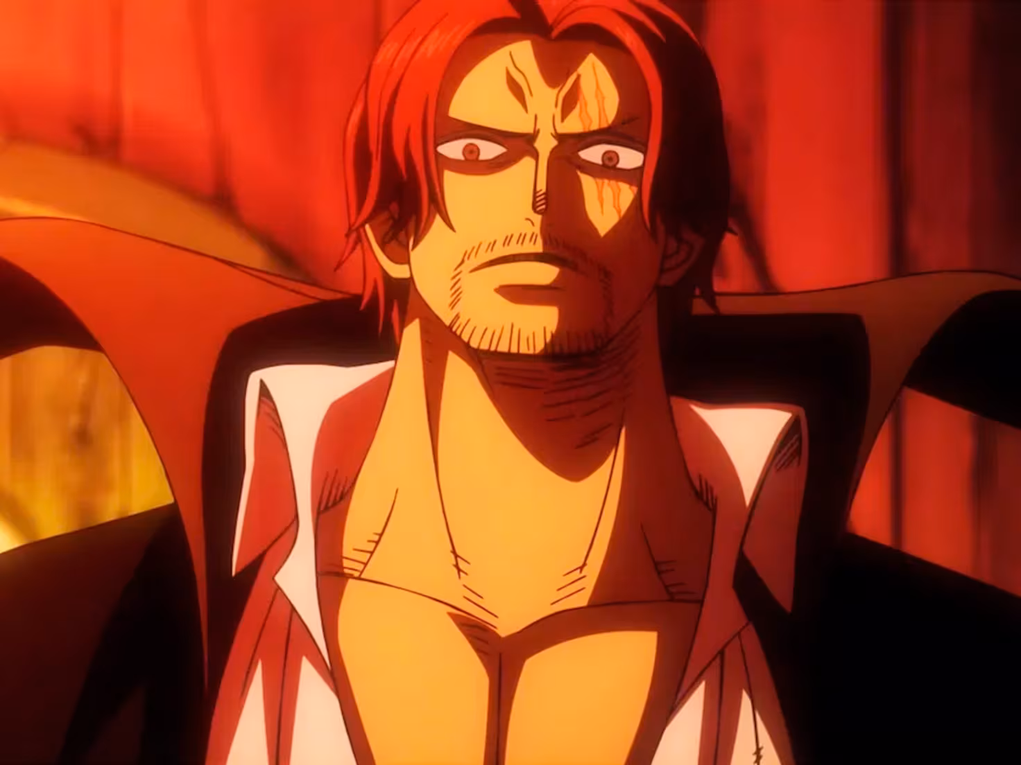 Shanks