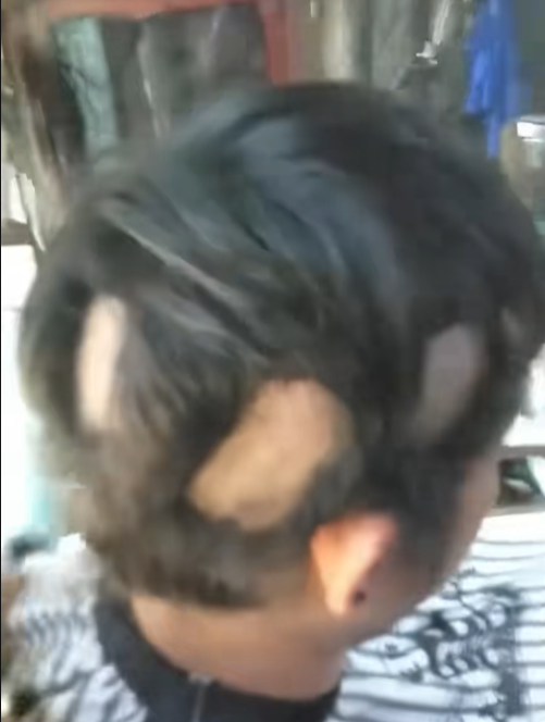 ทรงดาวลูกไก่